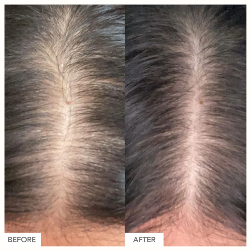 Hairtamin - Advanced Formula