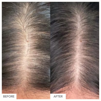Hairtamin - Advanced Formula